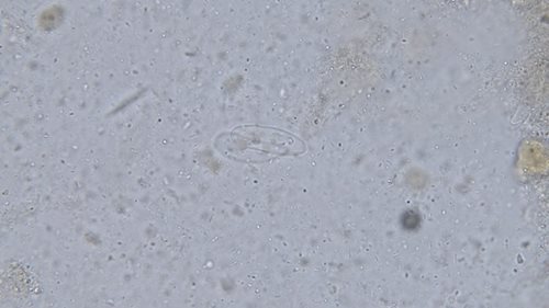 Faecal Analysis